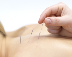 acupuntura01